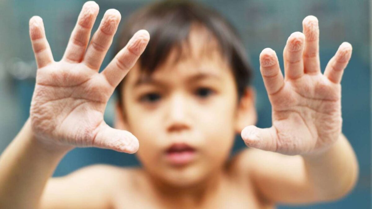 Como “pneus de chuva”, os dedos enrugados ajudam a segurar melhor superfícies escorregadias – depositphotos.com / wckiw