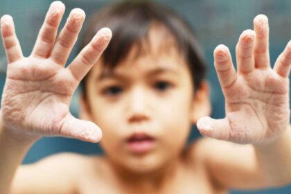 Como “pneus de chuva”, os dedos enrugados ajudam a segurar melhor superfícies escorregadias – depositphotos.com / wckiw