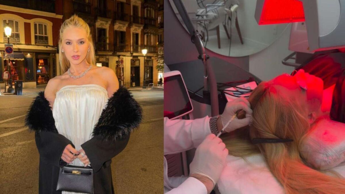 Saiba mais sobre a alopecia