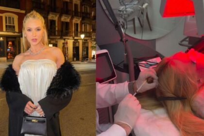 Saiba mais sobre a alopecia