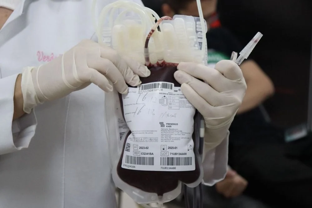 Pessoa com luvas brancas segura uma bolsa de sangue com etiqueta e tubos transparentes conectados.